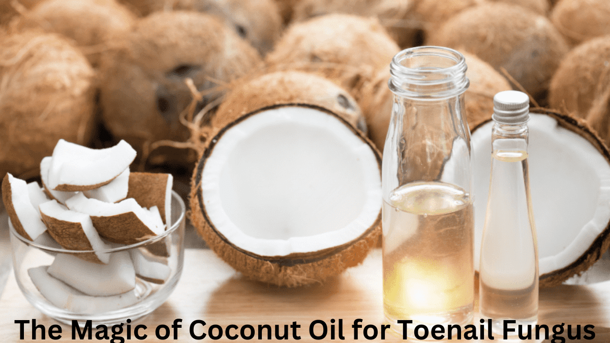 The Magic of Coconut Oil for Toenail Fungus