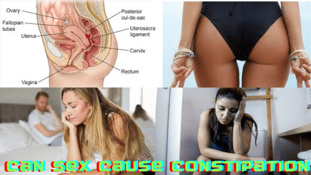 Can Sex Cause Constipation
